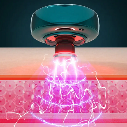 🔥✅Ventosa eléctrica celulitis + con 50% OFF + Envío Gratis a todo Chile 🔥✅